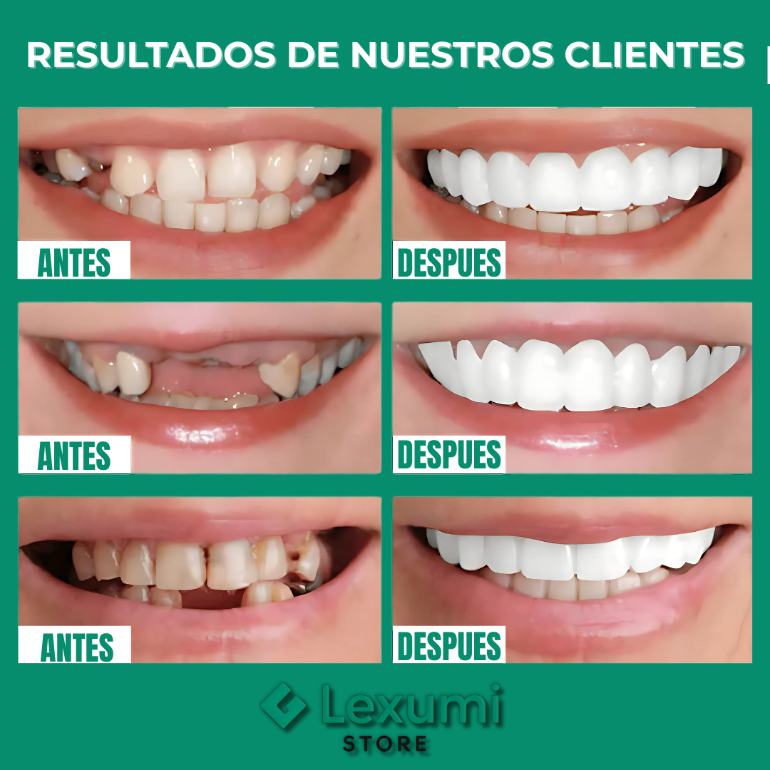 ¡OFERTA DE HOY!⌛CARILLAS DENTALES ADAPTABLES 2X1 +ENVIO GRATIS🏡🚚