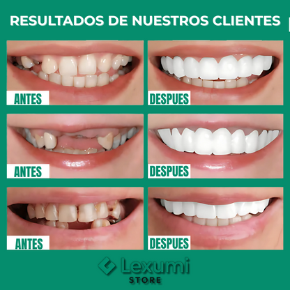 ¡OFERTA DE HOY!⌛CARILLAS DENTALES ADAPTABLES 2X1 +ENVIO GRATIS🏡🚚