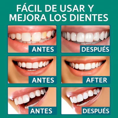 ¡OFERTA DE HOY!⌛CARILLAS DENTALES ADAPTABLES 2X1 +ENVIO GRATIS🏡🚚